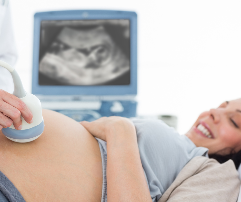 Lady lies down whilst having a fetal ultrasound. A screen behind her shows the image of the scan. 