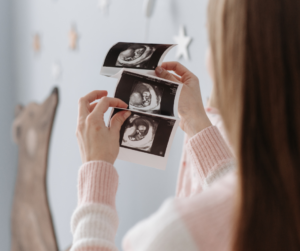 Scan pictures are held up as a pregnant woman looks at them