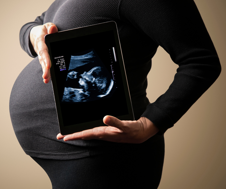 Woman with large baby bump holds up a tablet screen which shows a baby scan image.